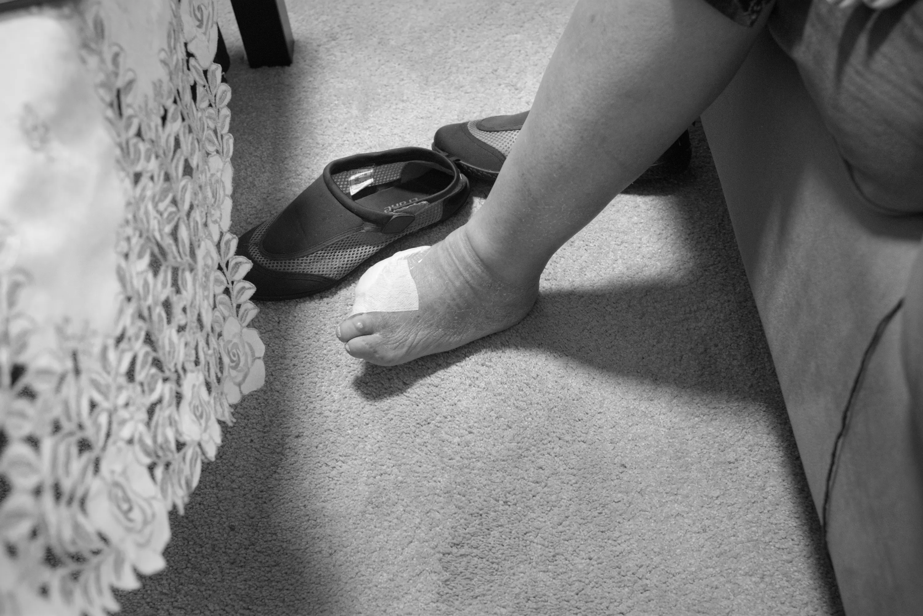 Bare foot with a bandaged toe resting on carpet beside a shoe